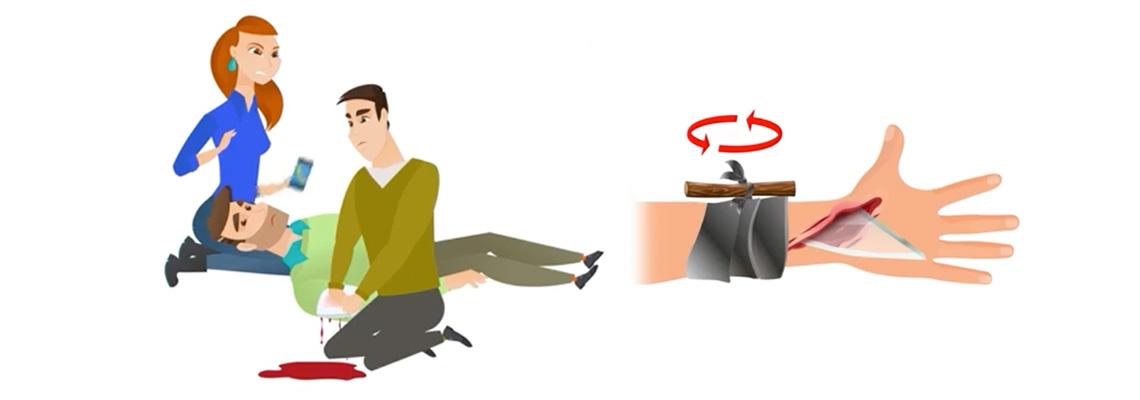 What to do in the event of an external haemorrhage