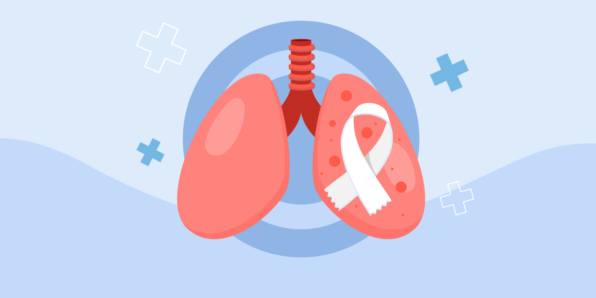 Dépistage du cancer du poumon : une nouvelle campagne de prévention à Monaco 