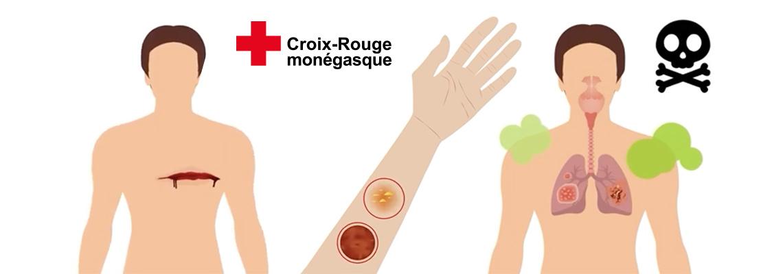 Come intervenire su una ferita o su un’ustione ?